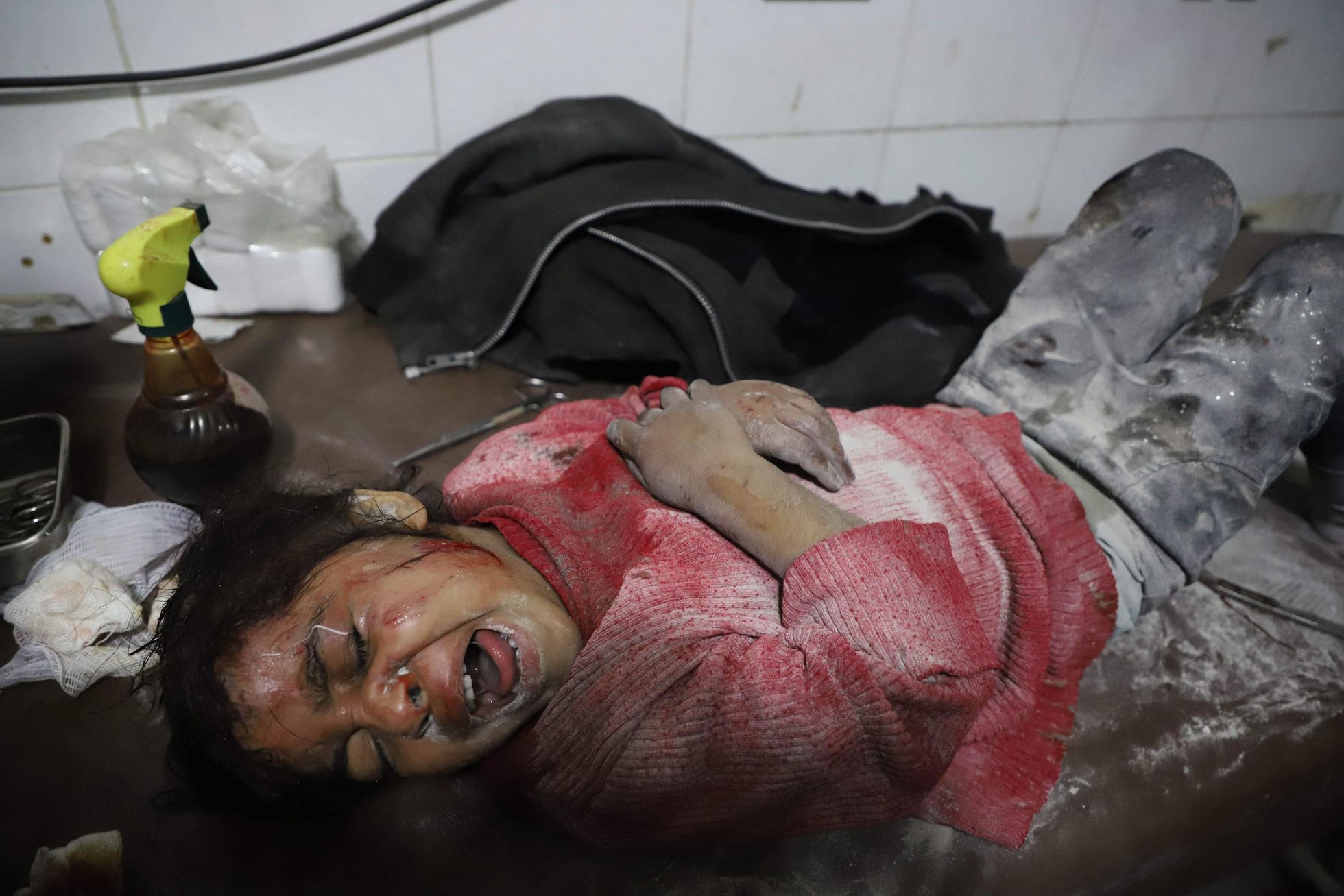 Süüria võimude rünnakus viga saanud tüdruk Ida-Ghouta haiglas aasta tagasi.