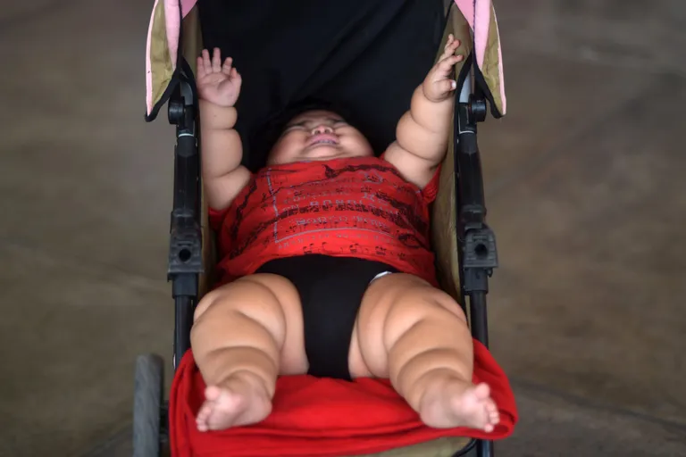 Kümnekuune mehhiko poiss Luis Manuel Gonzales kaalub 28 kilogrammi
