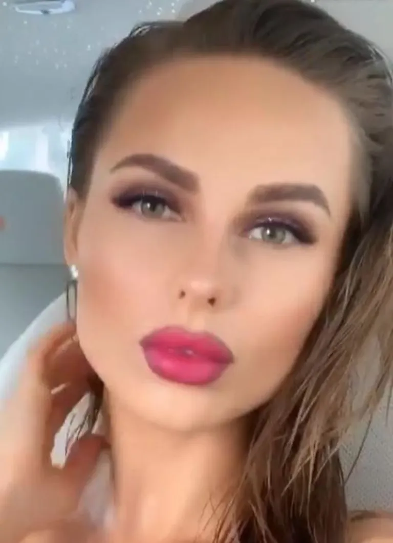 Губы певицы Ханны