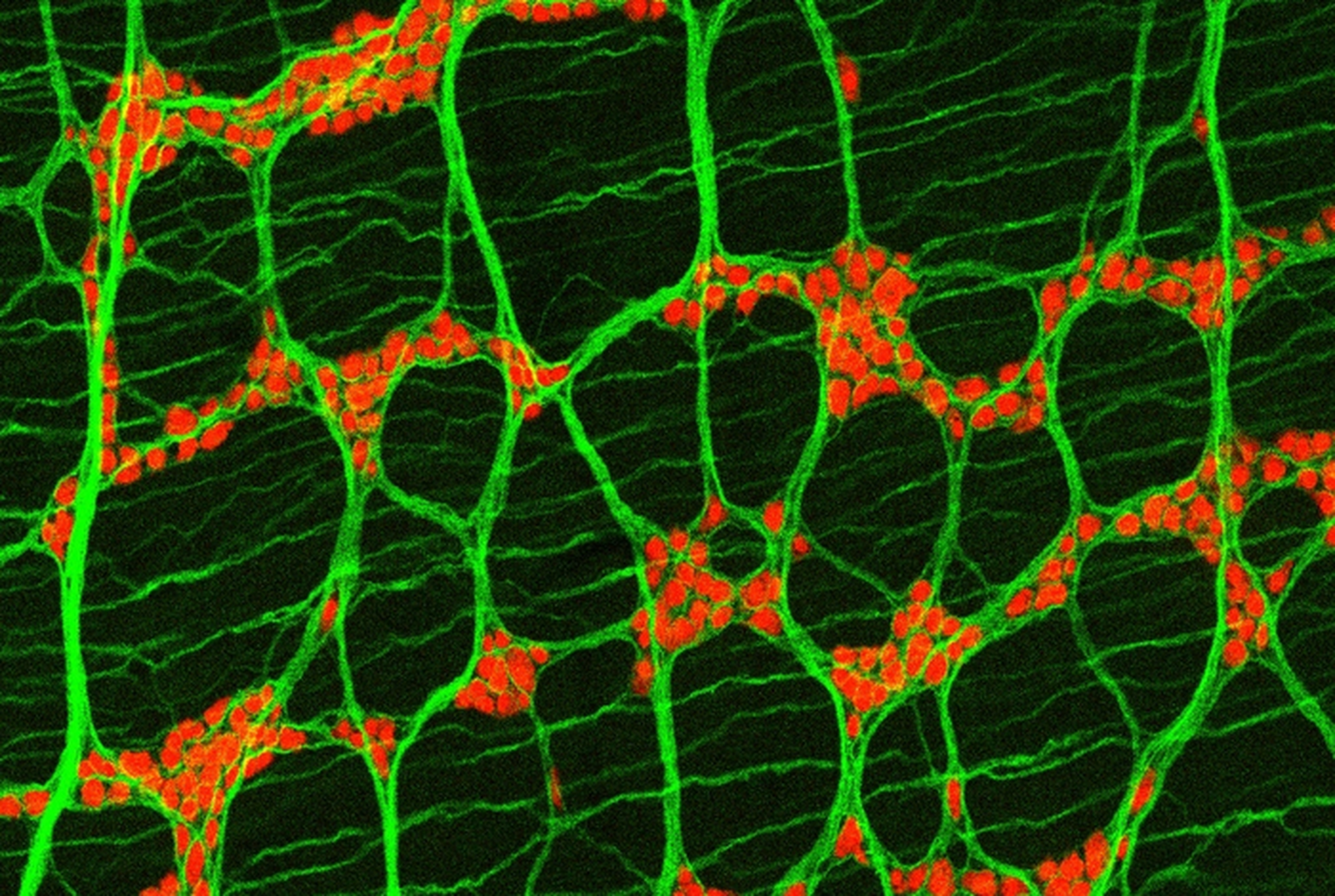 Pildil on näha neuroneid (punased) hiire käärsoole silelihaste kihis (rohelised).