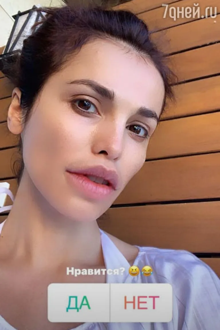 Сати Казанова увеличила губы