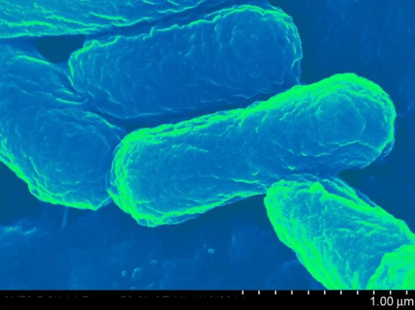 Escherichia coli bakterite abil kehasse viidud vaktsiinid olid märkimisväärselt pikema, tugevama ja efektiivsema toimega.