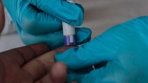 EESTI POLE ERAND ⟩ Süüfilis ja tripper levivad Euroopas rekordilise hooga