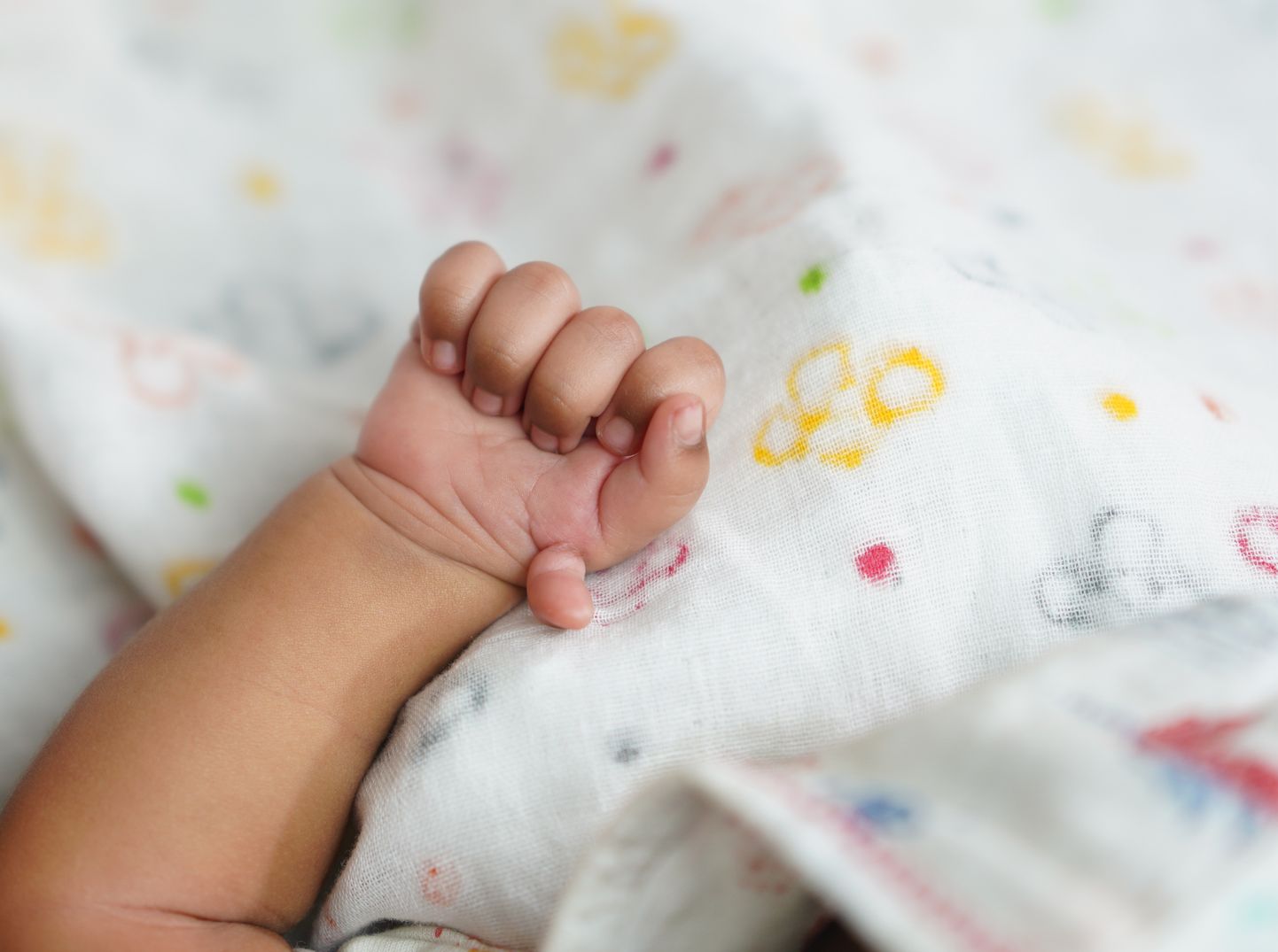 Polüdaktüülia on dominantse alleeli poolt põhjustatud geneetiline puue, mille tagajärjel inimese käel areneb rohkem kui viis sõrme.