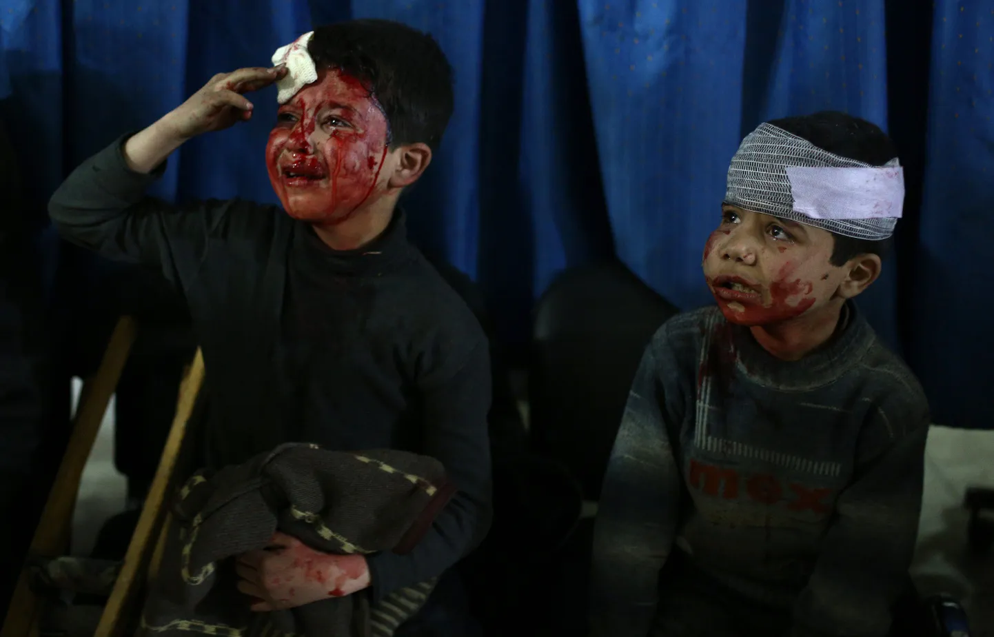 Vigastatud Süüria lapsed.