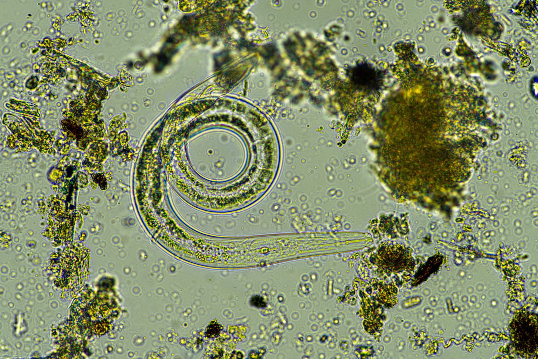 Ümaruss ja mikroorganismid mikroskoobi all. Pilt on illustreeriv
