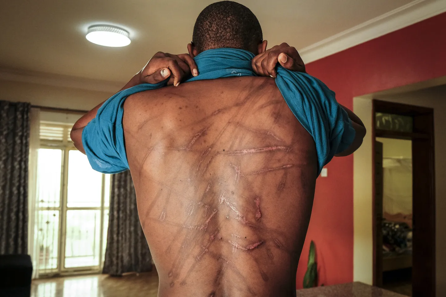 Kirjanik Kakwenza Rukirabashaija näitab enne kodumaalt põgenemist arme, mille tema sõnul tekitasid Uganda julgeolekujõudude esindajad nädalaid kestnud kinnipidamise käigus.