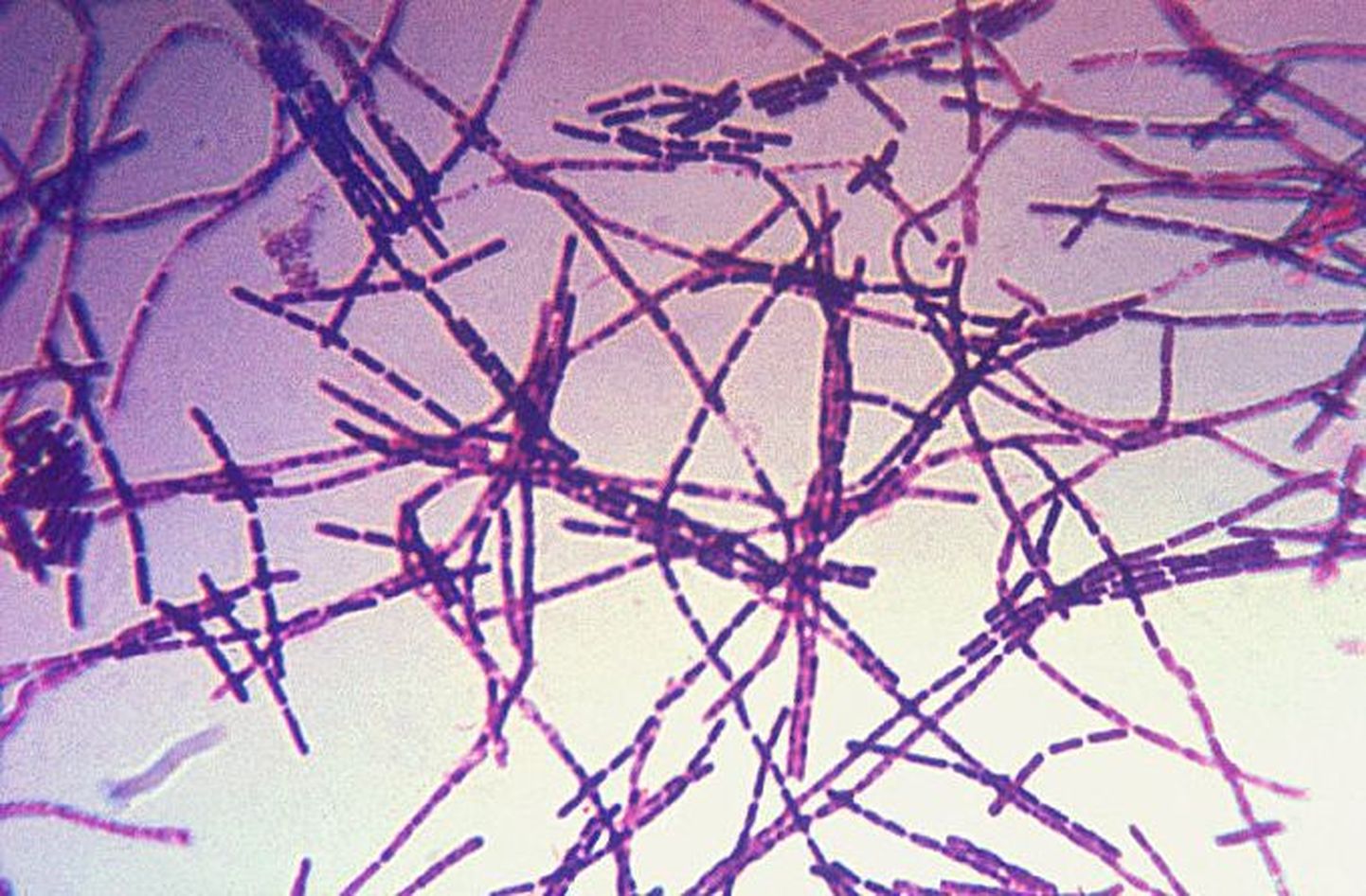 Antraksit ehk Siberi katku tekitab bakter Bacillus anthracis
