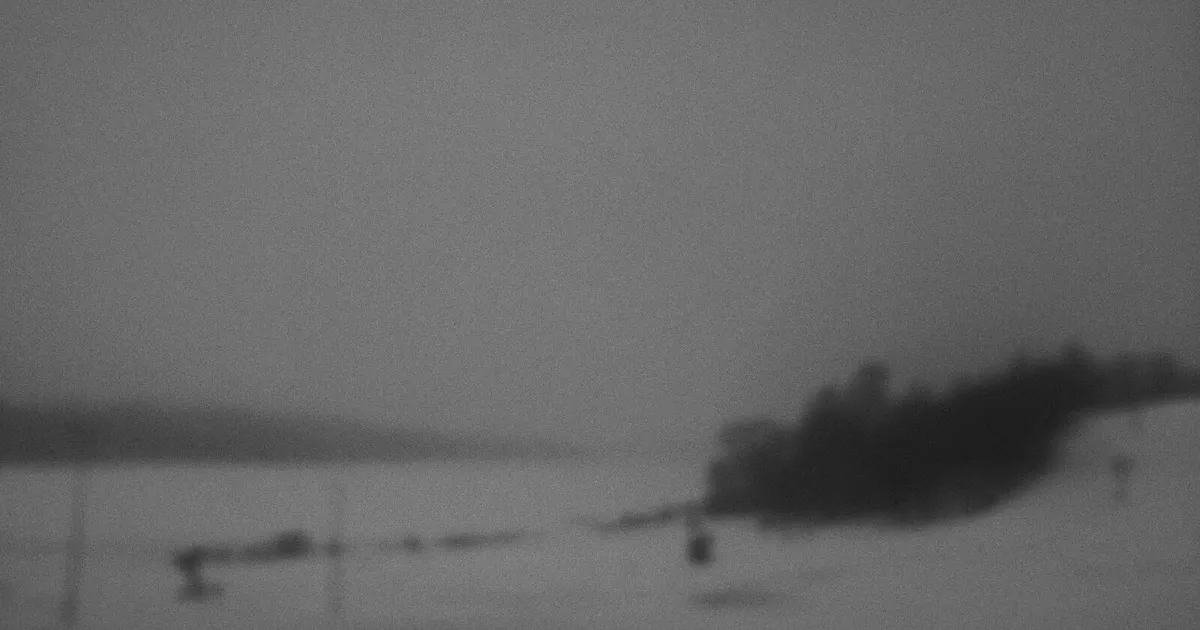 U külotlarini yon tomonga siljitdi (shaxsiy fotosurat)