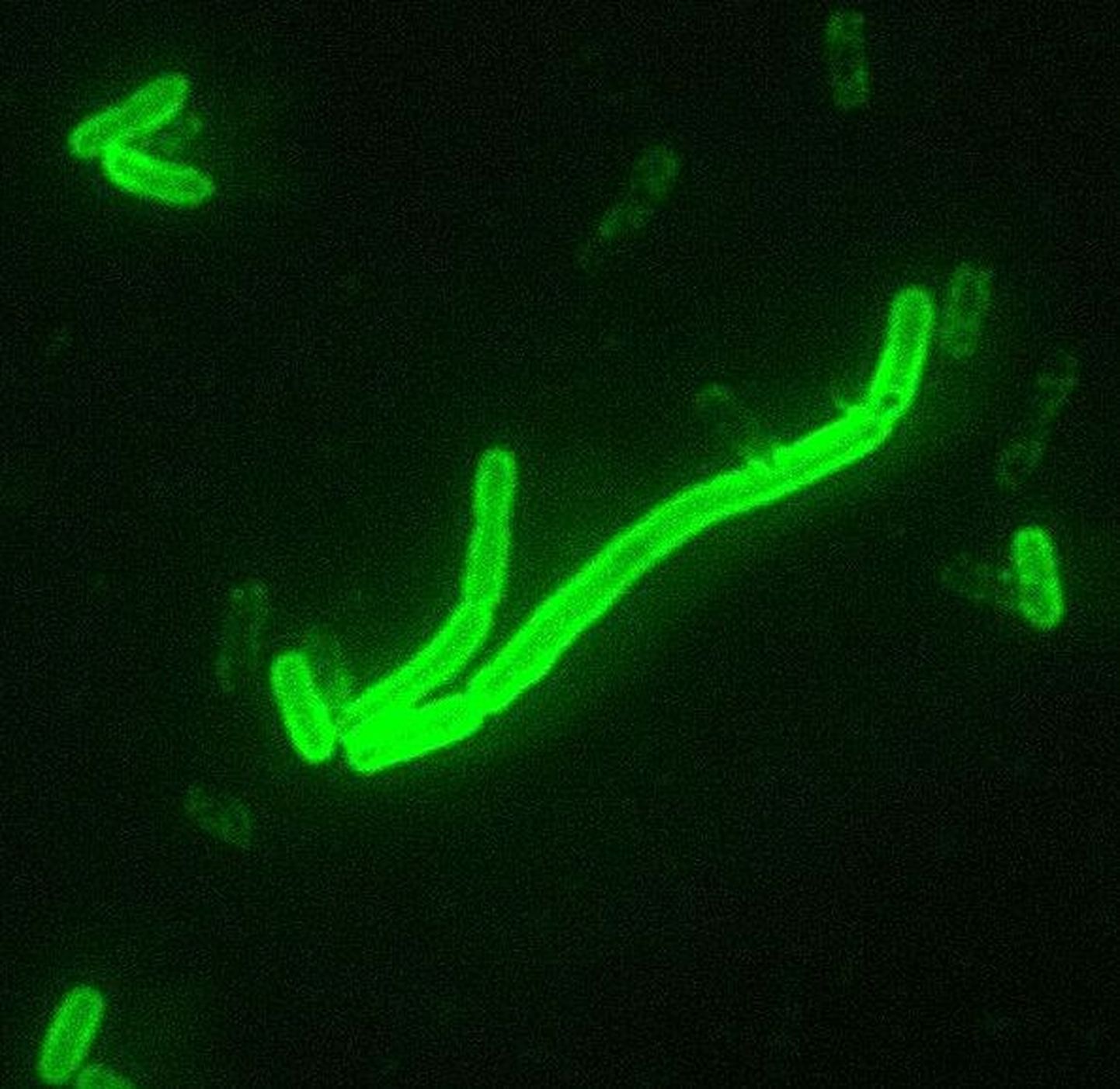 Bakter Yersinia pestis mikroskoobi all
