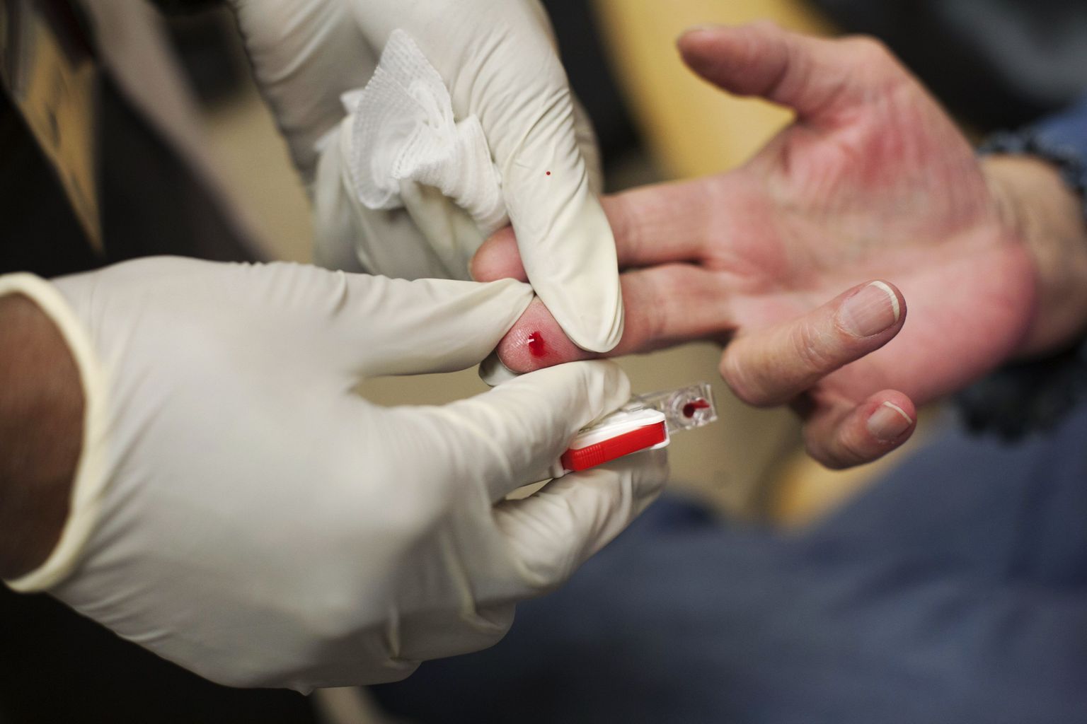 Antikoagulantide turul on on konkurents tihenenud. Pildil vereproovi võtmine enne ravi antikoagulantidega Staten Islandi ülikooli kliinikus USAs.