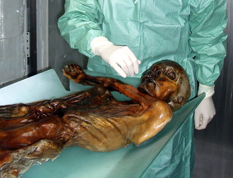 Alpidest leitud 5300-aastane mehemuumia, mis kannab nime Ötzi.