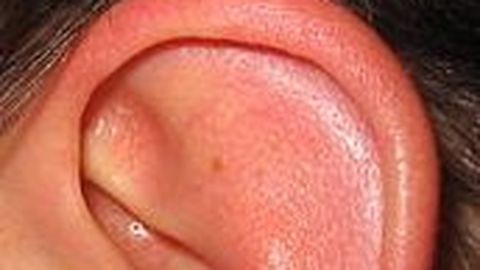 Шесть проблем с ушами, которые могут сигнализировать об опасных болезнях