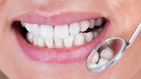 ПРОЩАЙТЕ, ИМПЛАНТАТЫ ⟩ Ученые выяснили, как заставить зубы снова расти