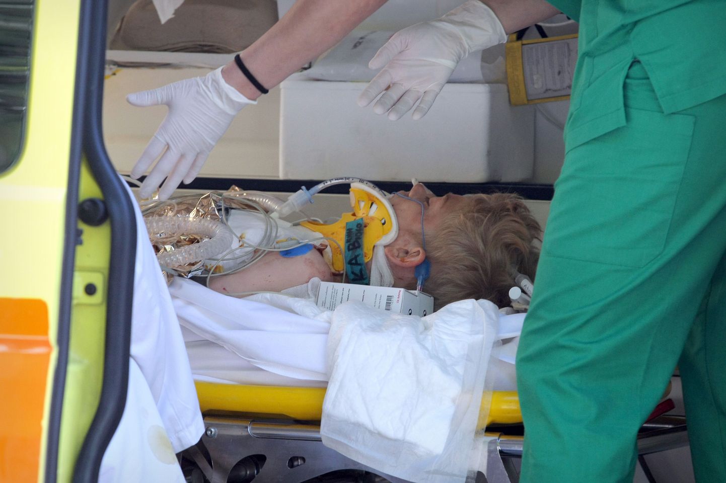 Врачи, занимающиеся лечением Никиты Онищенко, получившего 20 ножевых ранений от аниматора, привели ребенка в сознание.