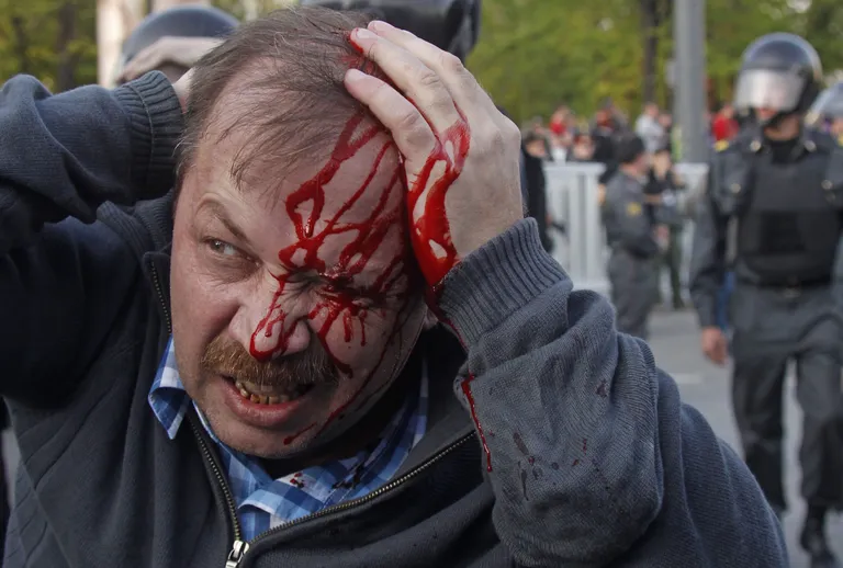 2012. aastal Venemaal aset leidnud meeleavalduste käigus vigastada saanud  mees. 