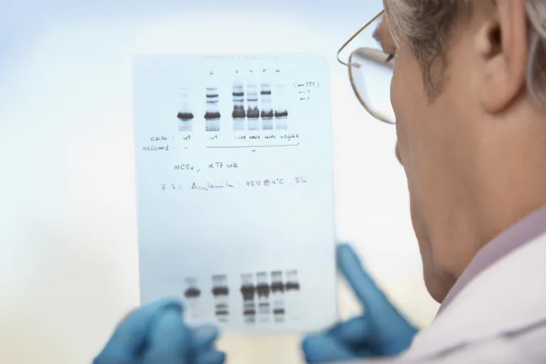 DNA-testi tulemused. Pilt on illustreeriv