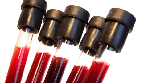 Mis saab juba analüüsitud vereproovist?