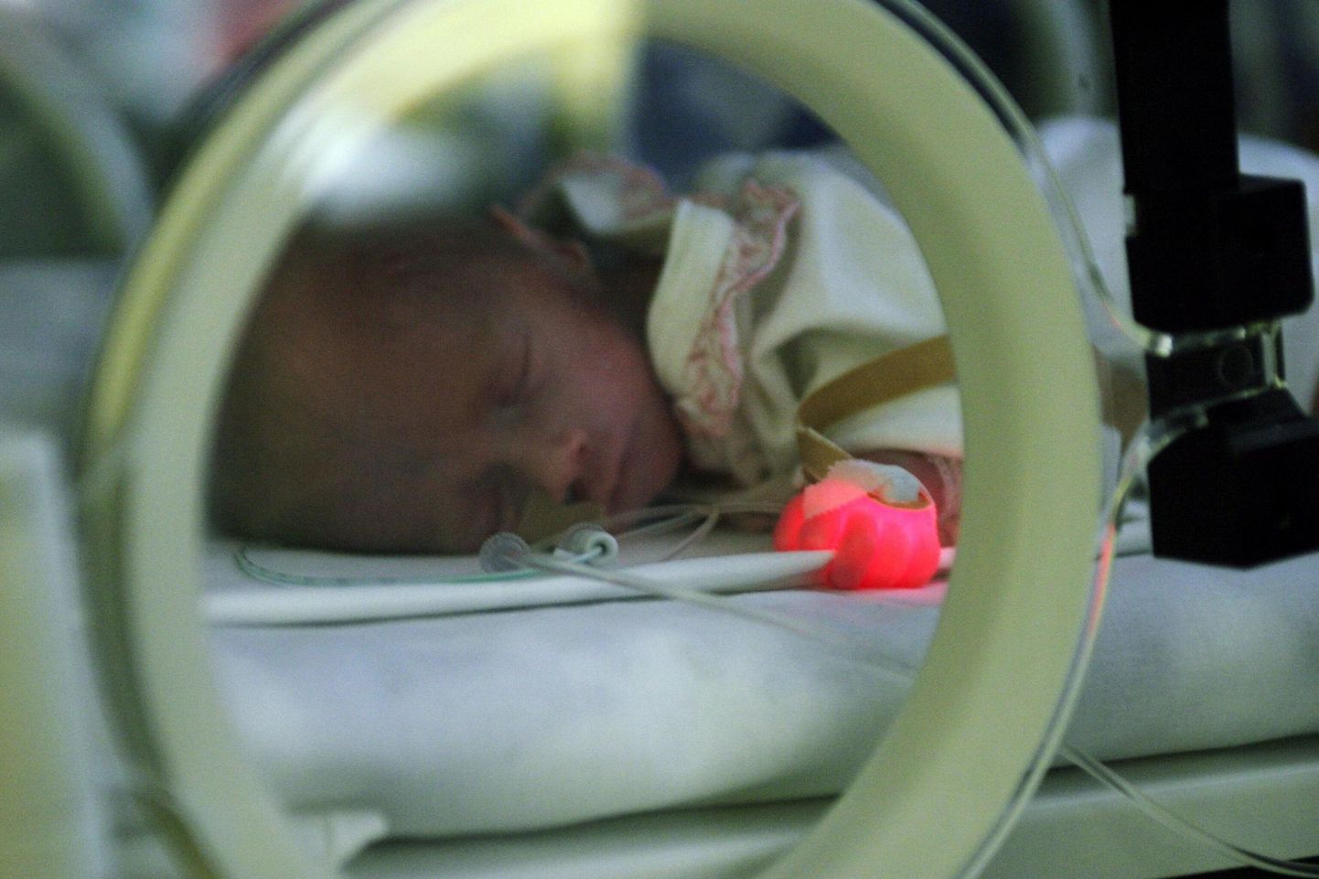Pärnu haiglas sünnib aastas 25–30 enneaegset last.
