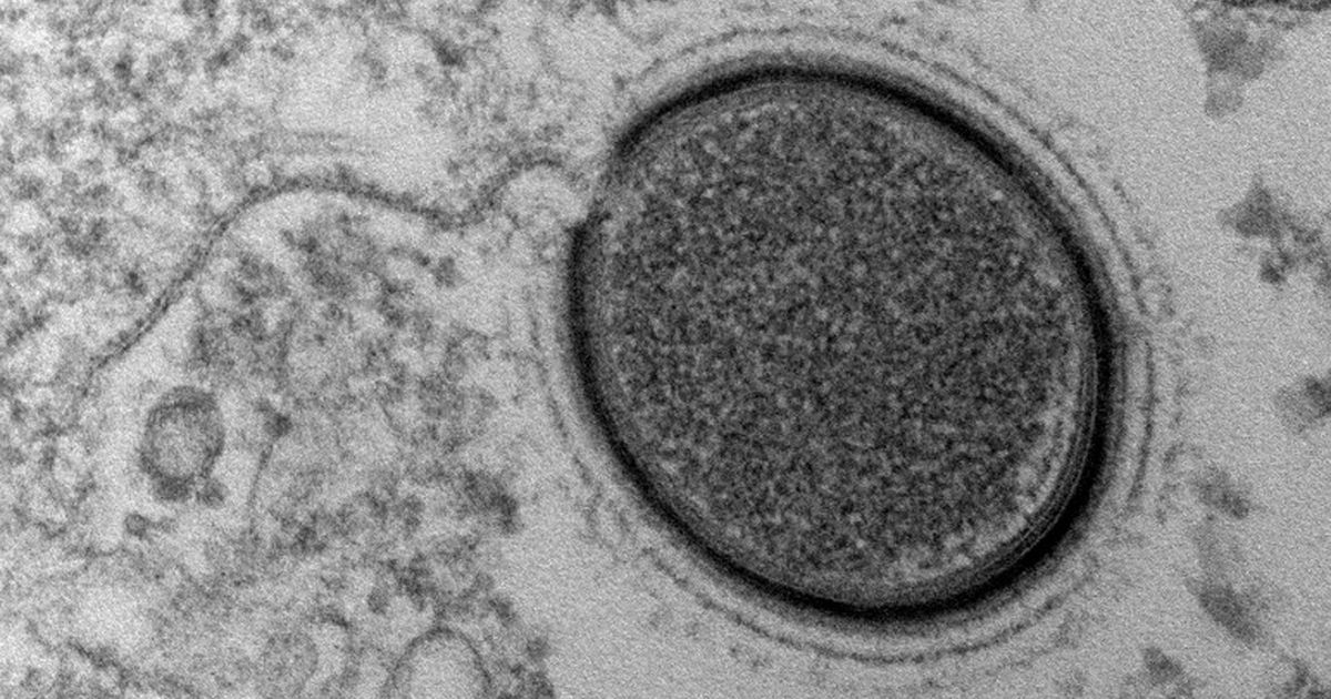 Uue pandeemia võivad vallandada Siberi igikeltsast välja sulavad iidsed viirused