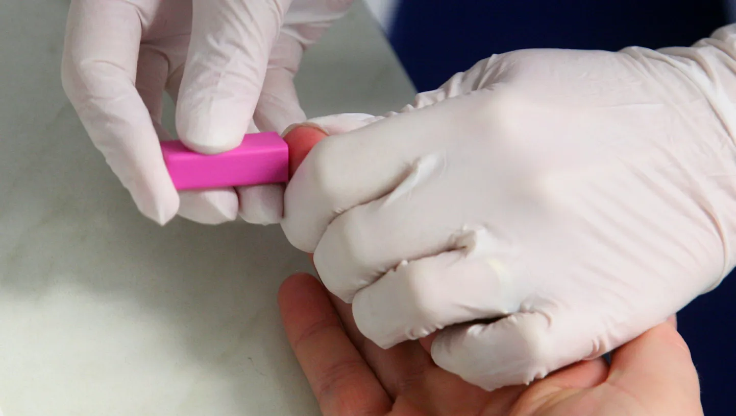HIV-i kiirtesti komplekt.
