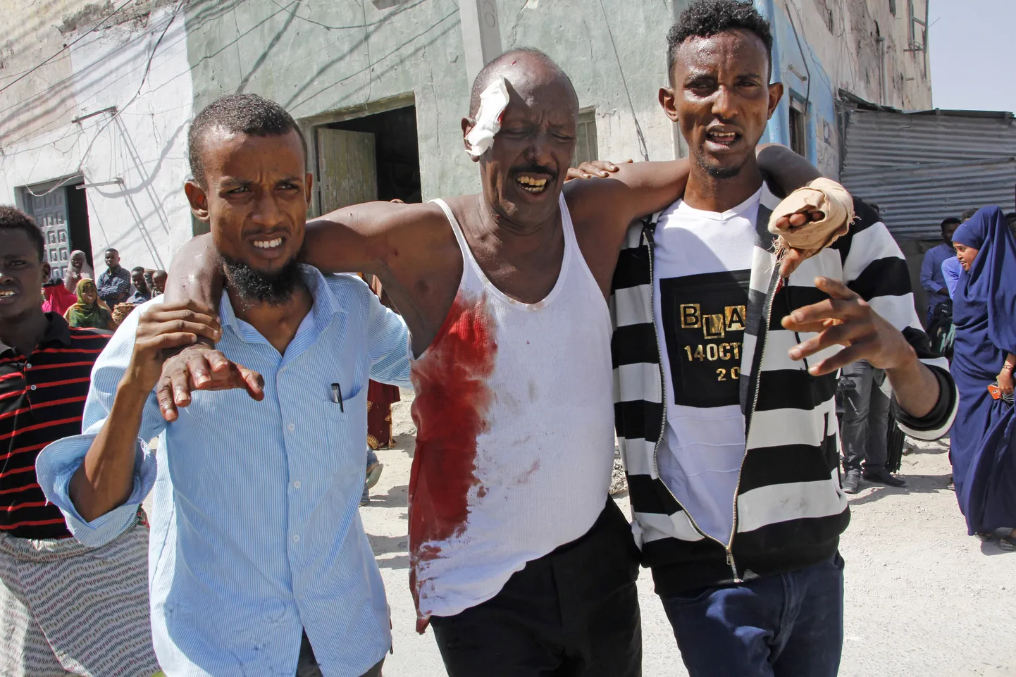 Somaalia pealinnas Muqdishos täna toimunud kaksikplahvatuses kannatada saanud mees sündmuskohal.
